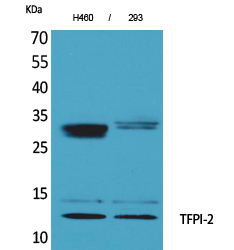 WB - TFPI-2 Polyclonal Antibody AP73342